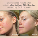 Mahonia Clear Skin Booster 25ml-5