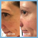 Evolve | Age Defying Lifting Serum 30ml-4