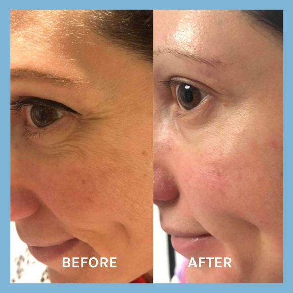 Evolve | Age Defying Lifting Serum 30ml